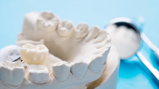 dentist crown denture
