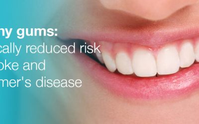 Healthy Gums Lower Stroke and Alzheimer’s Risk
