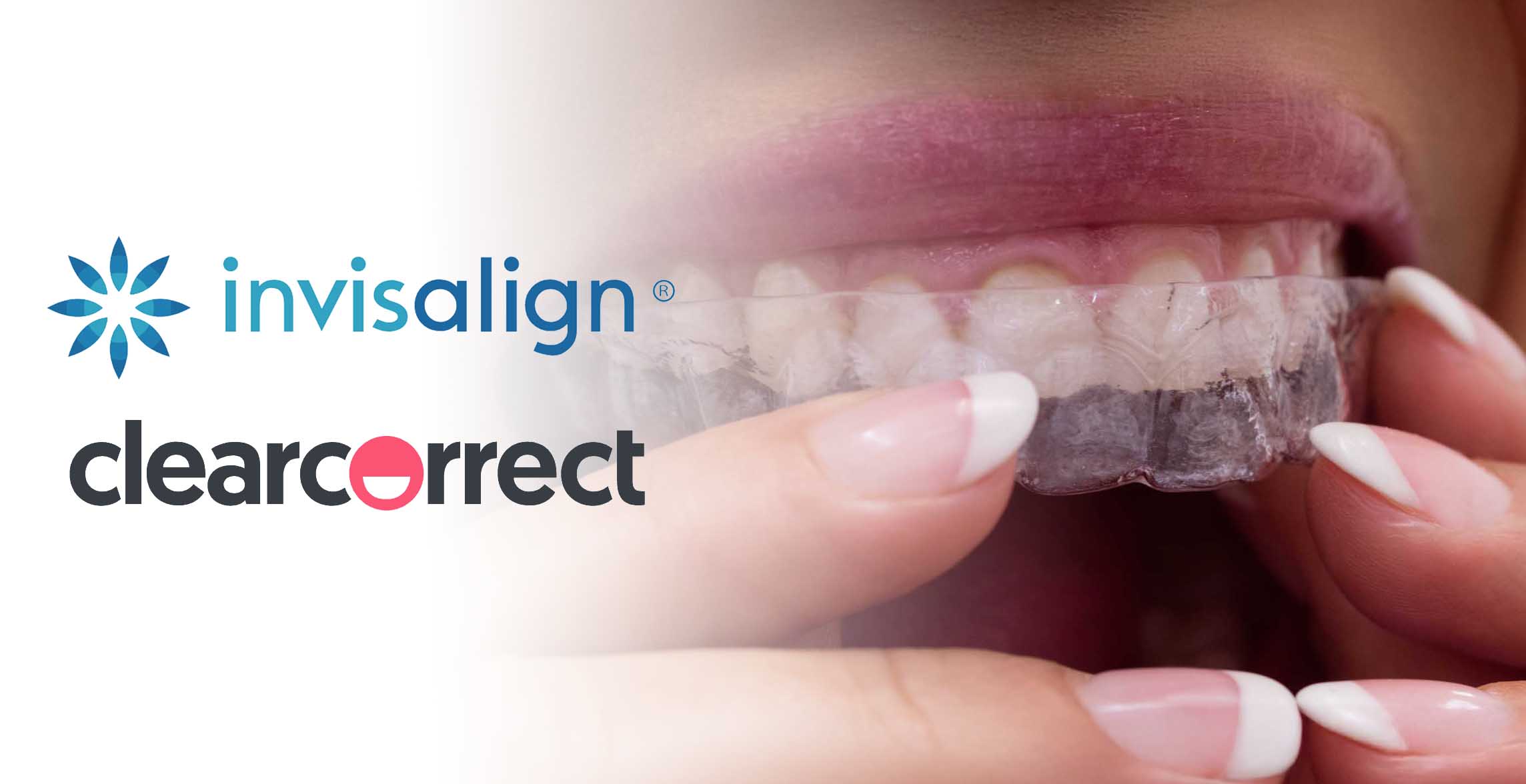 COSMETIC DENTISTRYORTHODONTICS AND CLEAR ALIGNERS COSMETIC DENTISTRYORTHODONTICS AND CLEAR ALIGNERS 1 1