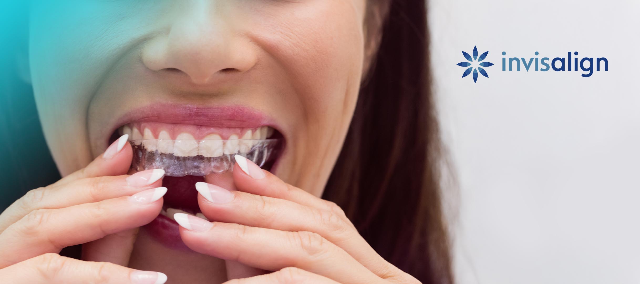 invisalign in saskatoon Image